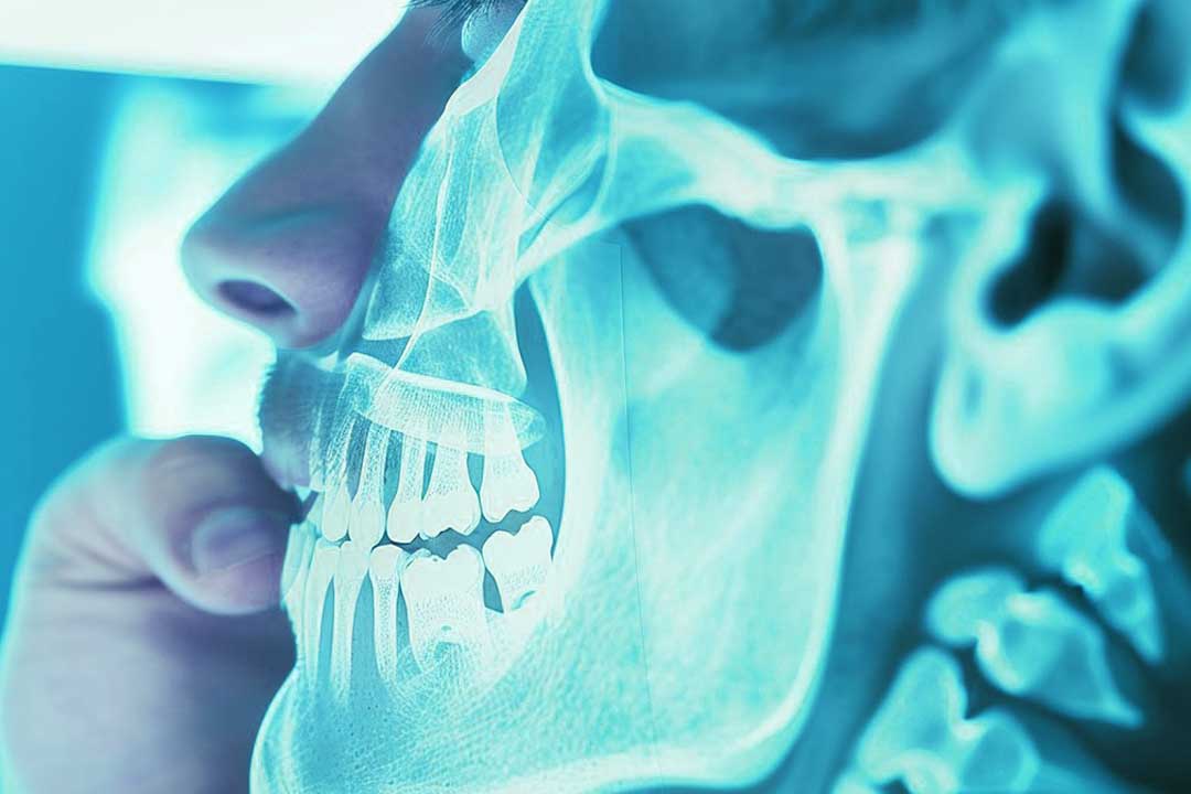 Radiologija